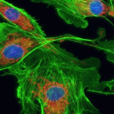 怎么提高顯微鏡的熒光成像的質(zhì)量？